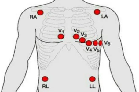 心电图正确位置图
