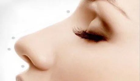 鼻翼缩小术会有什么后遗症