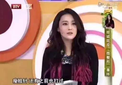 张馨予整容了吗？是演员敬业的体现吗？