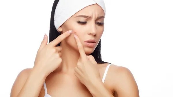 19岁宁波女孩挤痘痘引发颅内感染  医生：“危险三角区”别乱挤