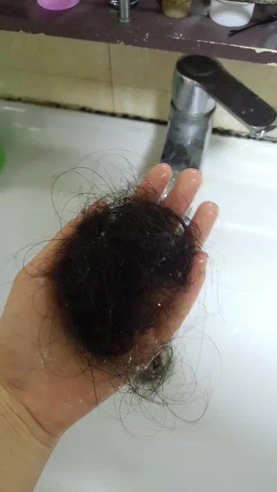 霸王防脱发好用吗？