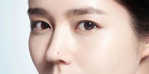 鼻尖整形价格是多少钱