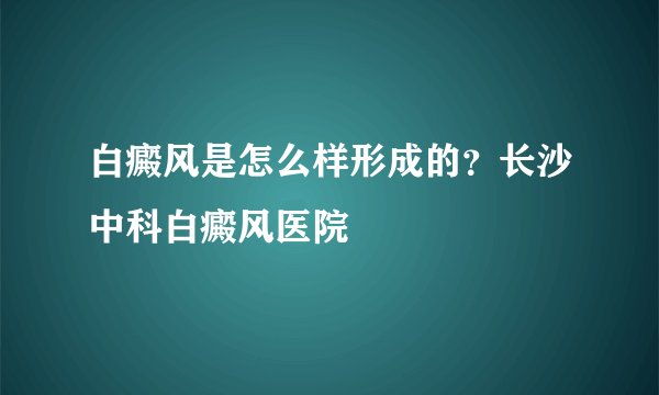 白癜风是怎么样形成的？长沙中科白癜风医院