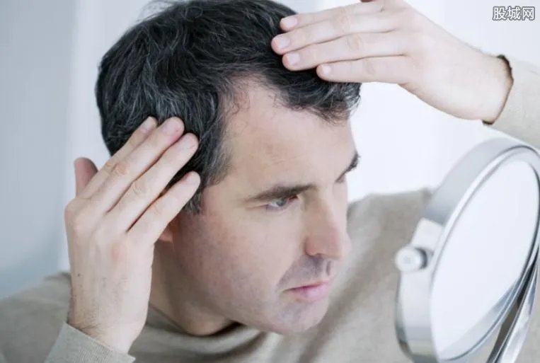 种头发贵吗 种头发大概会需要多少钱？