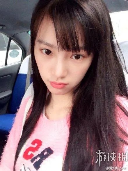 武大女神黄灿灿又整？打了两斤的苹果肌到底是什么鬼