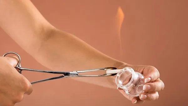 颈椎病拔火罐治疗管用吗