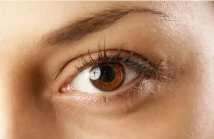 上睑下垂矫正要多少钱