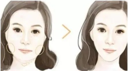 瘦脸针持续多长时间