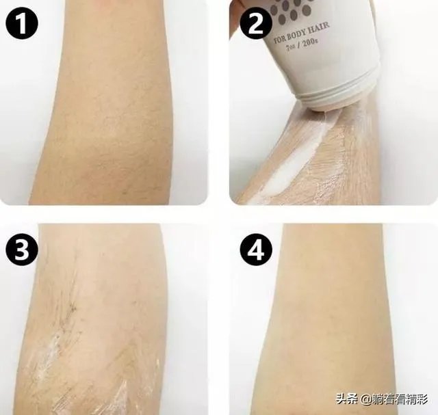 夏季脱毛用什么？