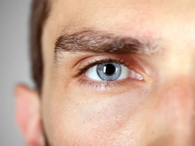 上睑下垂应该怎么办