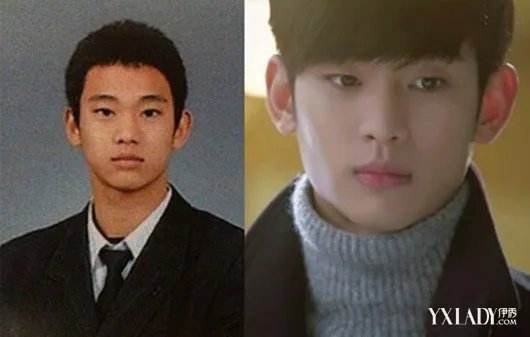 金明洙整容照片曝光韩国男星出道前后对比照
