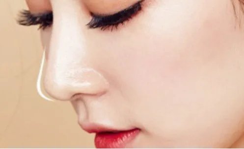 玻尿酸隆鼻后会疼吗