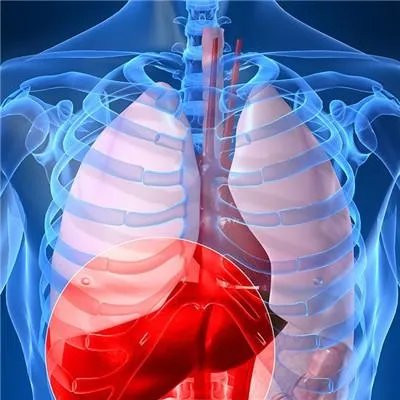 肝病的症状有哪些