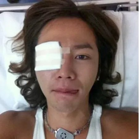 张根硕被打 究竟是真是假？