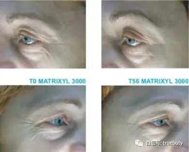 为什么高端护肤品喜欢添加胜肽这种物质？