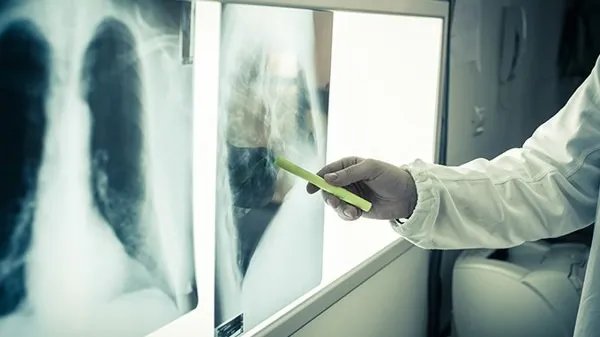 全球日增确诊超71万例 近1/3美国人20年底已感染新冠