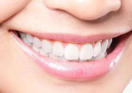 牙齿美白需要多少钱