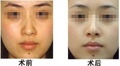 美白嫩肤的最有效方法