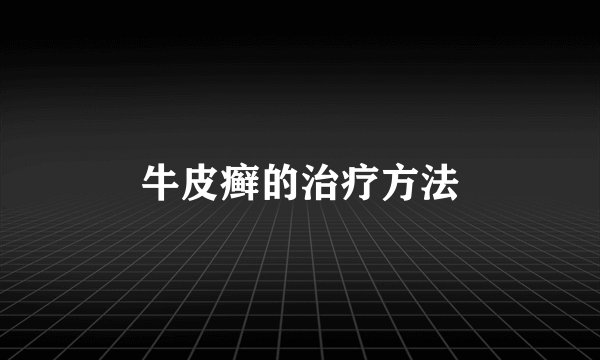 牛皮癣的治疗方法