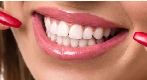 一颗种植牙的价格