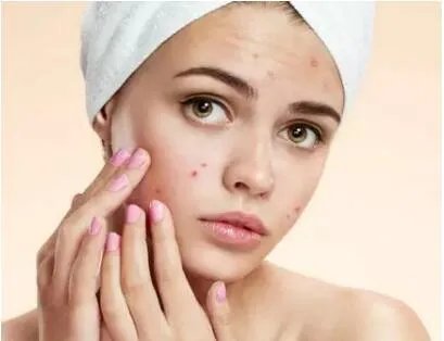 做祛痘需要多少钱？费用是多少？