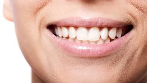 地包天怎么才能矫正