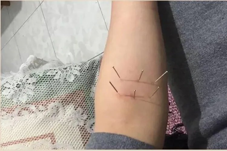 喉灵六针的准确位置图