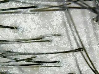 霸王防脱发好用吗？