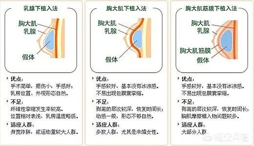 隆胸的填充物是什么?对身体有什么伤害?