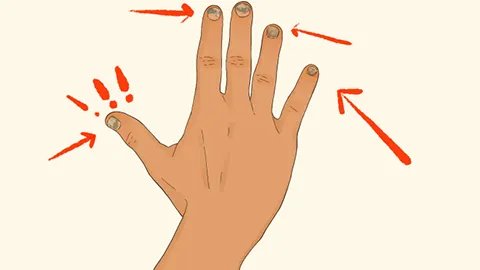 长灰指甲是什么原因