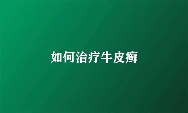 如何治疗牛皮癣
