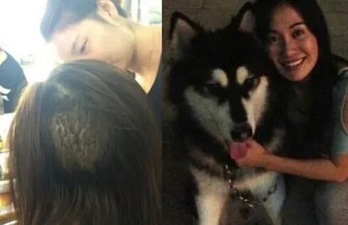 李依晓被叶璇狗咬图片触目惊心 揭秘事件始末