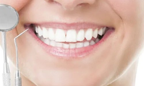 美容冠牙齿矫正多少钱 