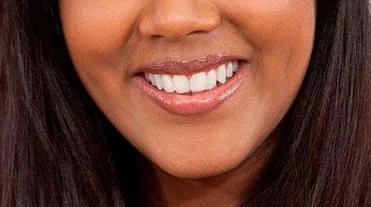 牙齿矫正要多少费用