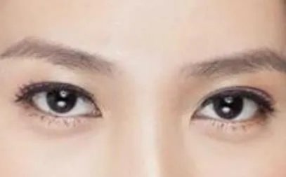 怎样去眼袋和皱纹