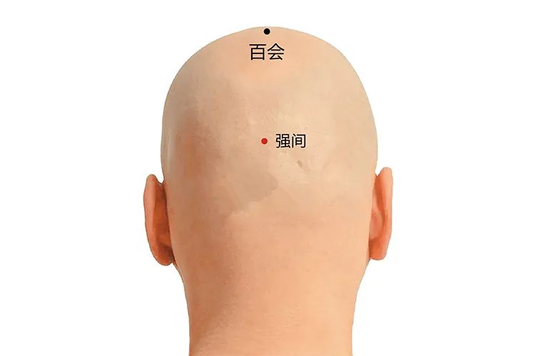 百会的准确位置图