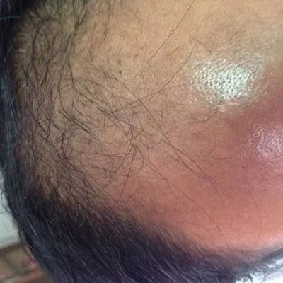 掉头发厉害是什么原因