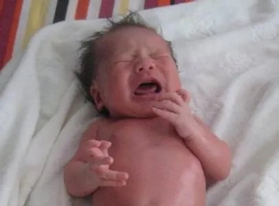 对于父母将婴儿放微波炉这个事件，孩子以后会有什么后遗症吗？