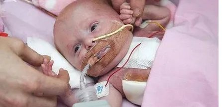 心脏长在体外存活概率有多大？