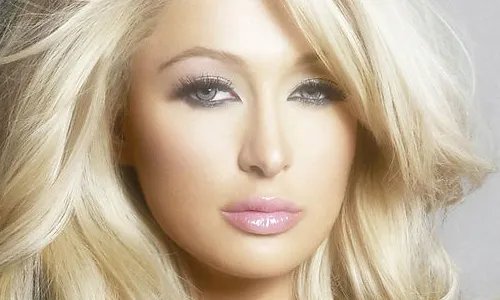 激光去除痘印价格