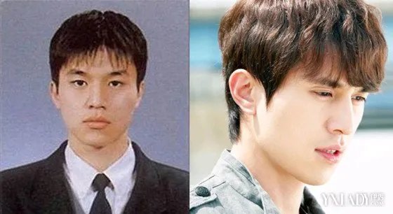 金明洙整容照片曝光韩国男星出道前后对比照