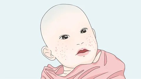 土豆治疗湿疹吗