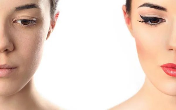 做面部疤痕修复需要多少钱？费用是多少？