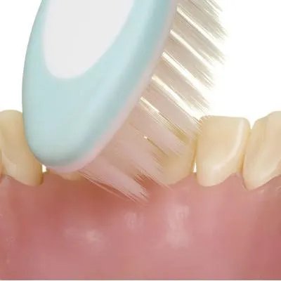 种植牙镶牙费用