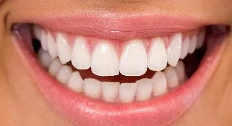 牙齿矫正的价格一般要多少钱的呢