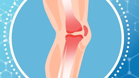 股骨骨折有什么后遗症