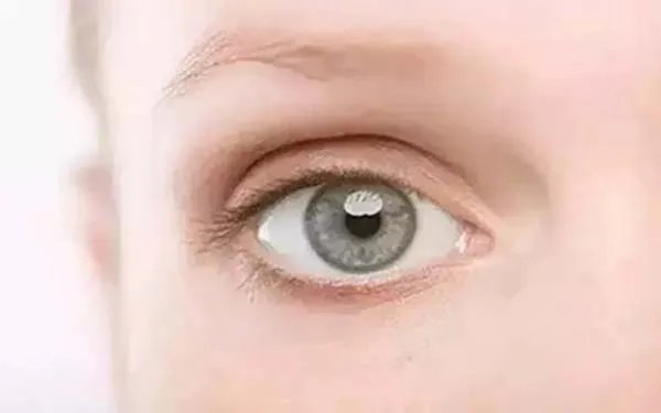 广州好的双眼皮整形医院在哪