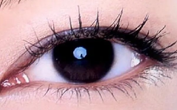 北京割双眼皮手术多少钱呢