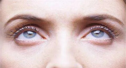 广州好的开眼角整形医院在哪