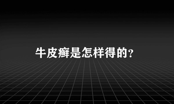牛皮癣是怎样得的?